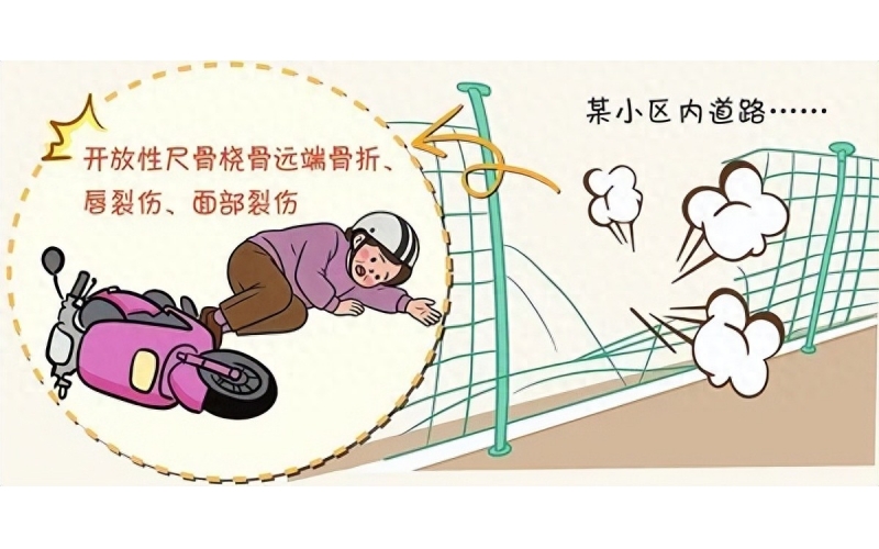 小區內騎行電動車轉彎處摔傷，開發商與物業公司是否需擔責？